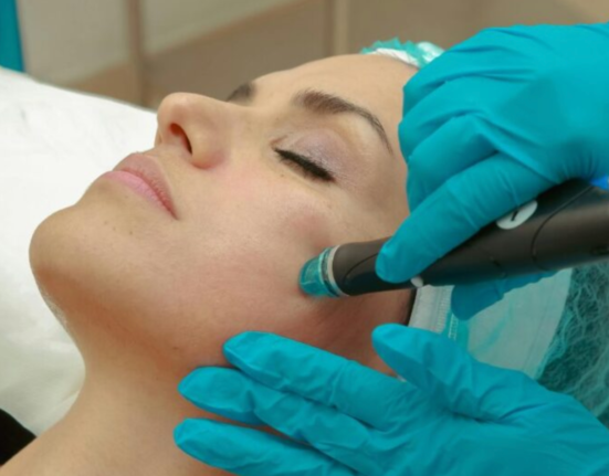 Laser Hair Removal Sessions