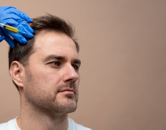 Hair Transplant in Turkey