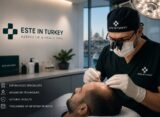best hair transplant clinics in Turkey
